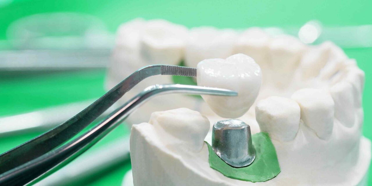 https://skydentalcancun.com/wp-content/uploads/2020/01/post-28-1280x640.jpg