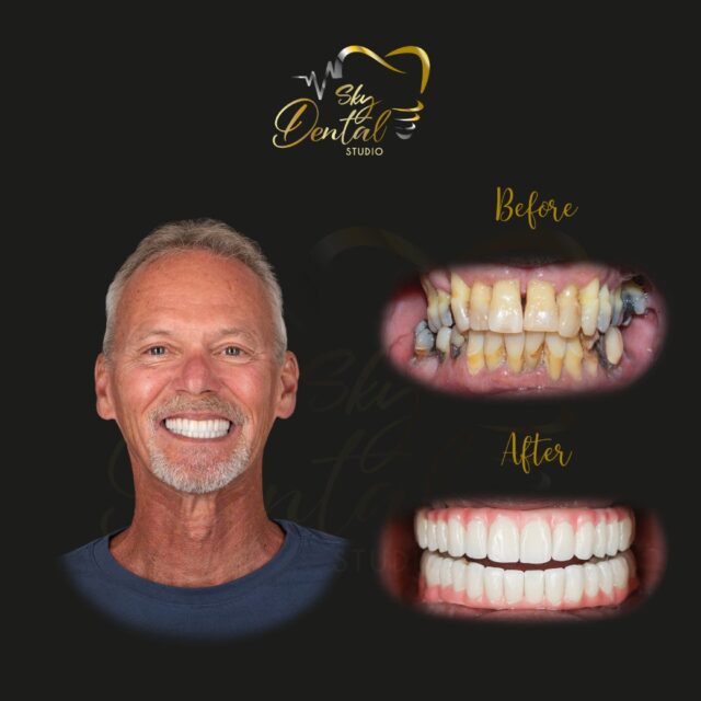 Patient Restoration Patient Restoration