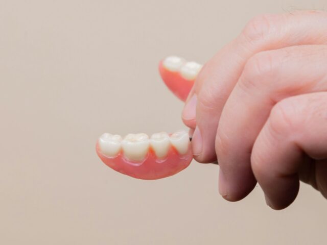 Implant Bridge vs Dentures: Which Fits You?