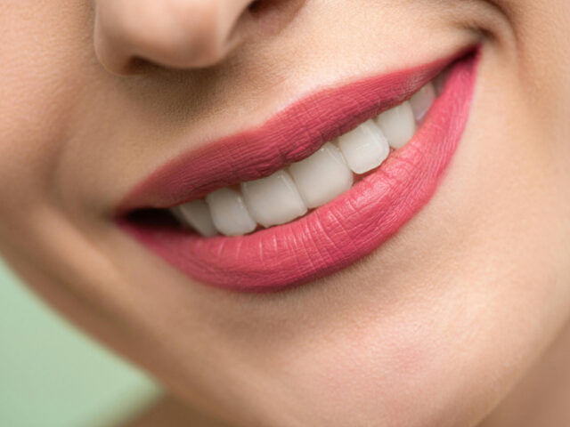 Full Mouth Restoration Guide for Patients