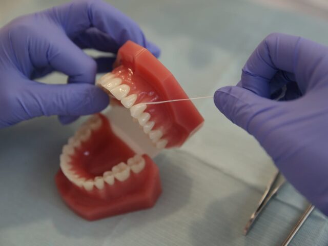 How to Floss All on 4 Dental Implants