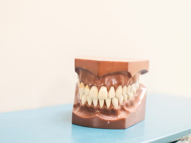 All on 6 Treatment Guide for New Smiles