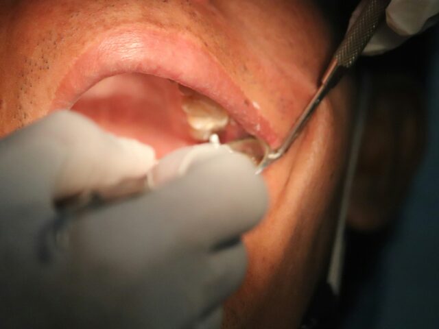 Can I Fly After Oral Surgery? What to Know