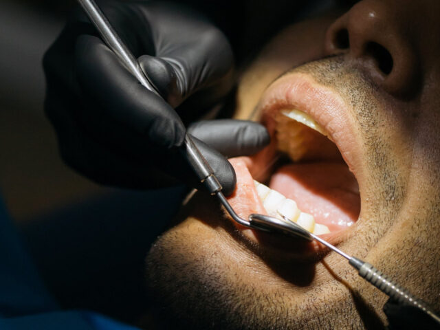 Is Dental Work Safe Abroad? What to Check