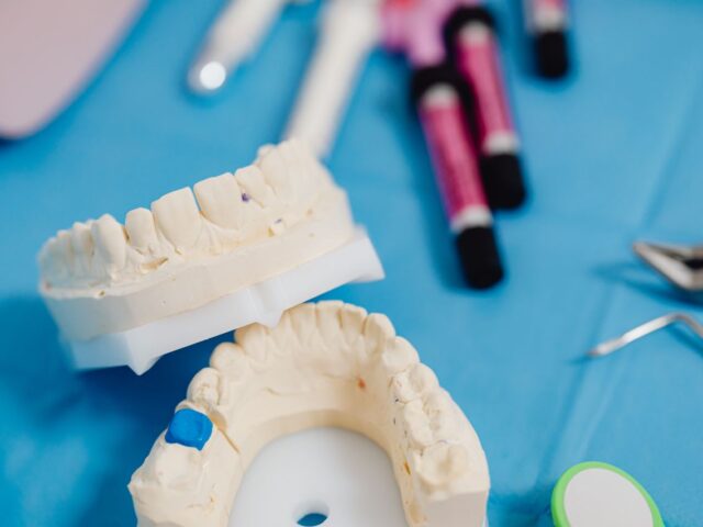 Full Arch Implants vs Removable Dentures