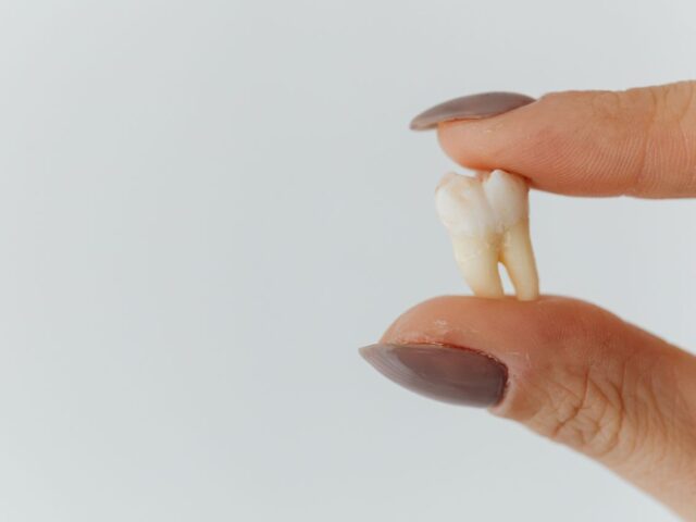 Best Options for Missing Teeth Explained