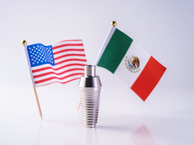 Mexico Dental Implants vs USA Costs and Care